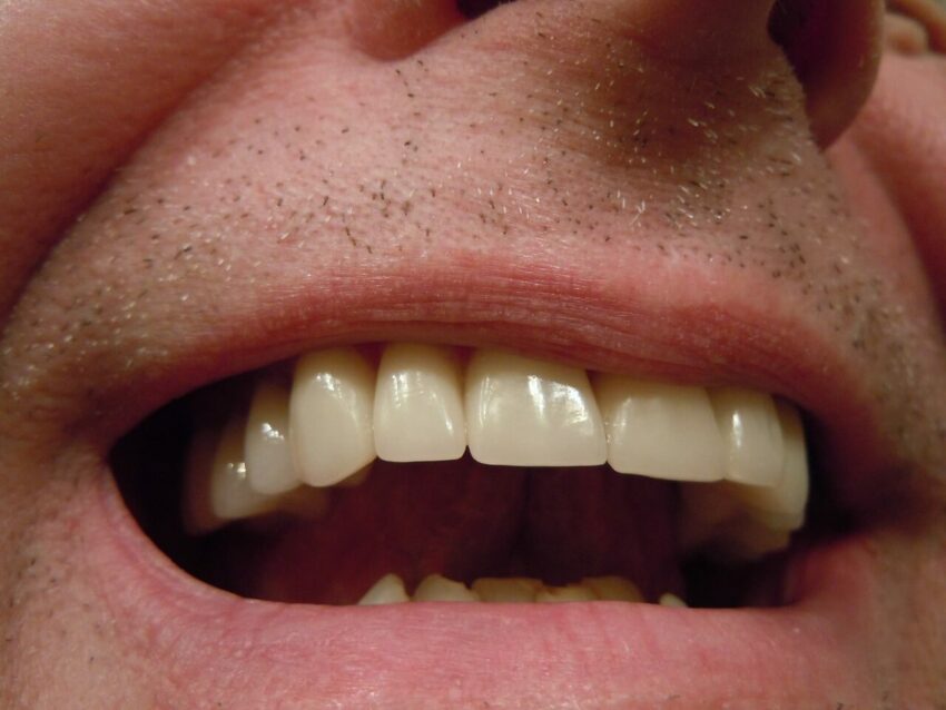 Czy szkliwo zębów się regeneruje