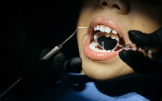 Czy podcięcie wędzidełka języka boli?